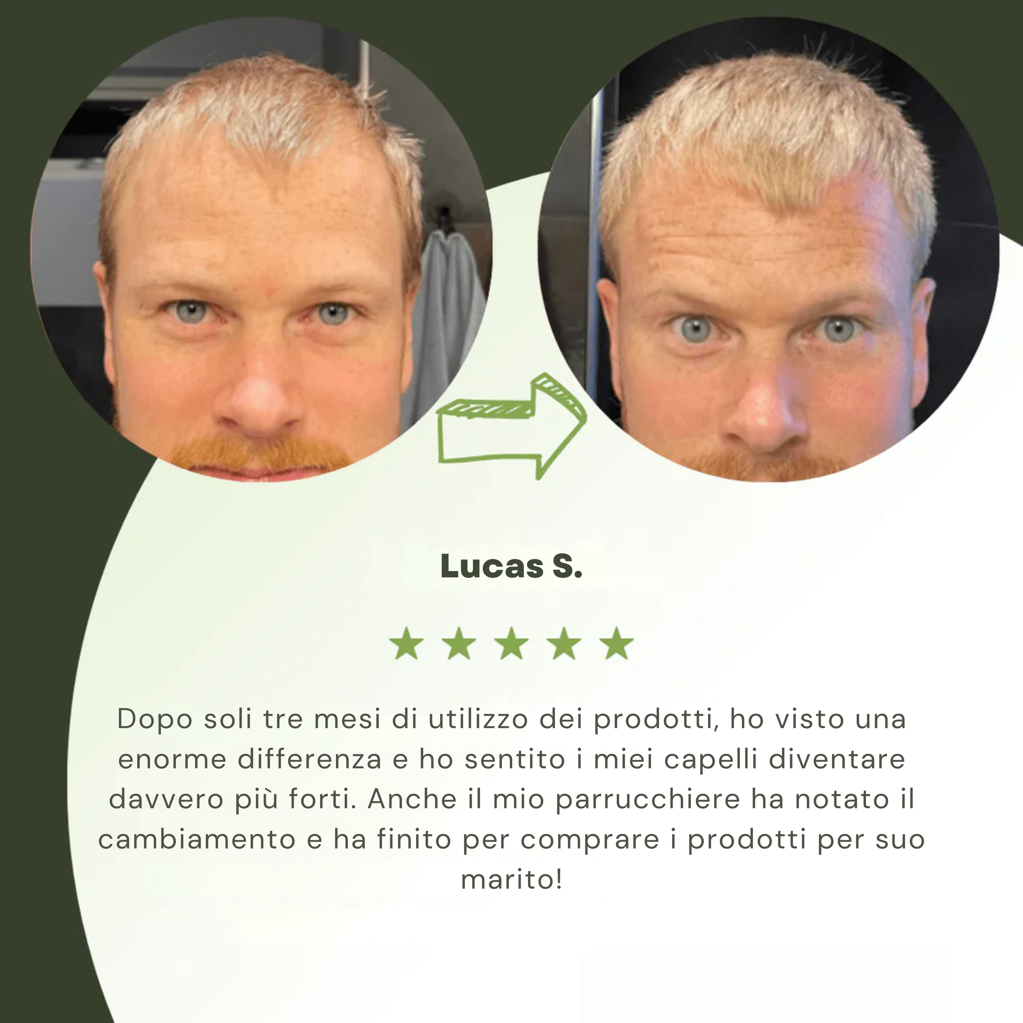 Siero di crescita capillare per uomini