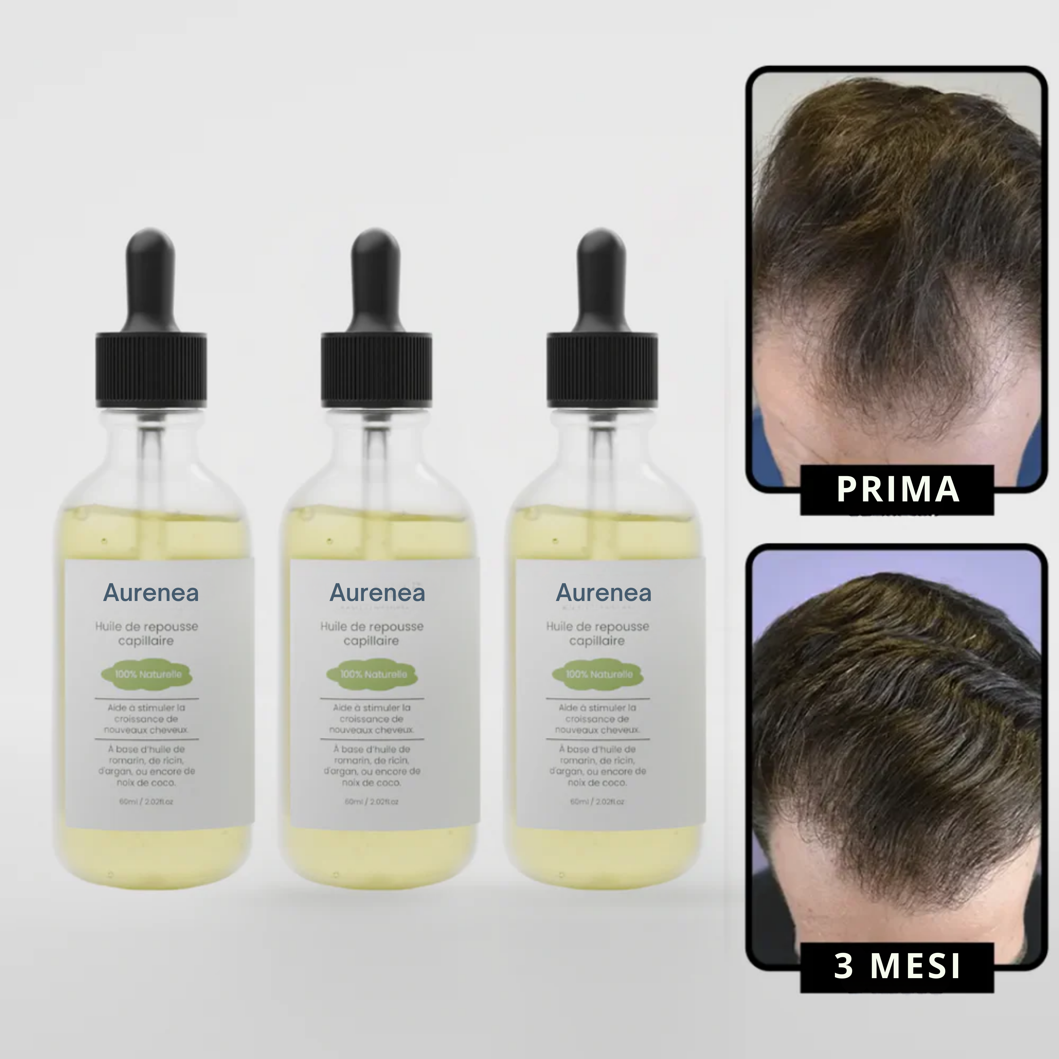 Siero di crescita capillare per uomini