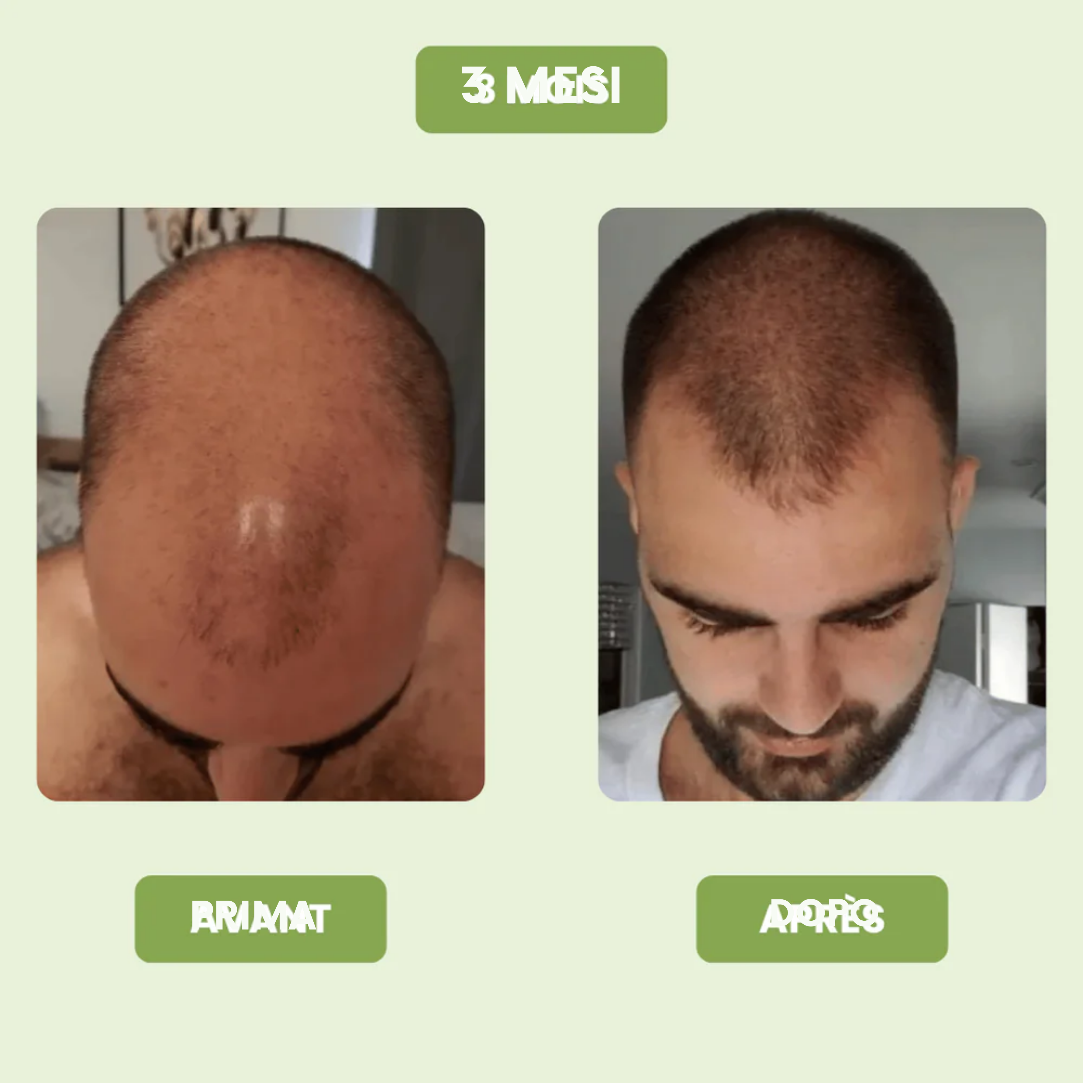 Siero di crescita capillare per uomini