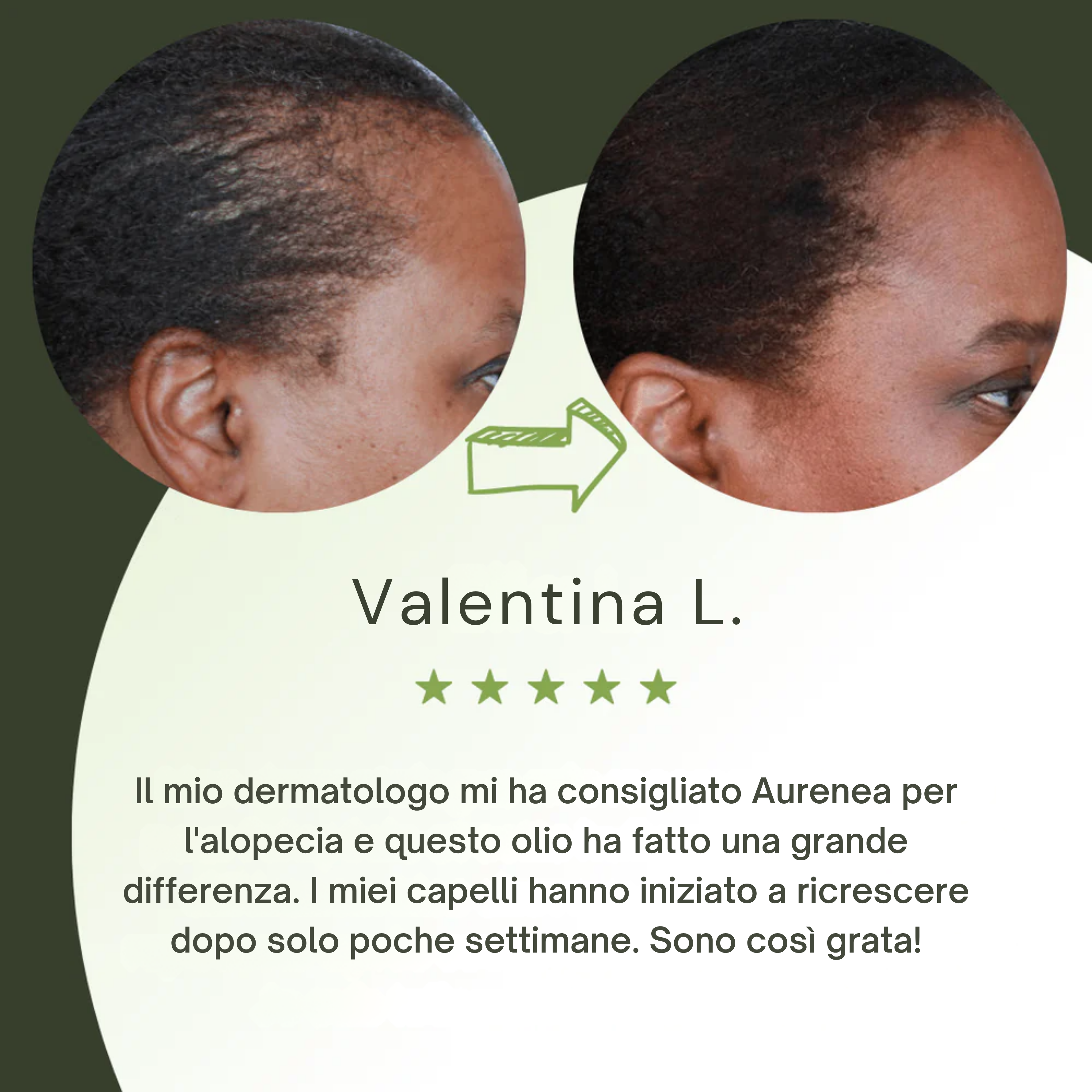 Siero per la crescita dei capelli (60 ml)